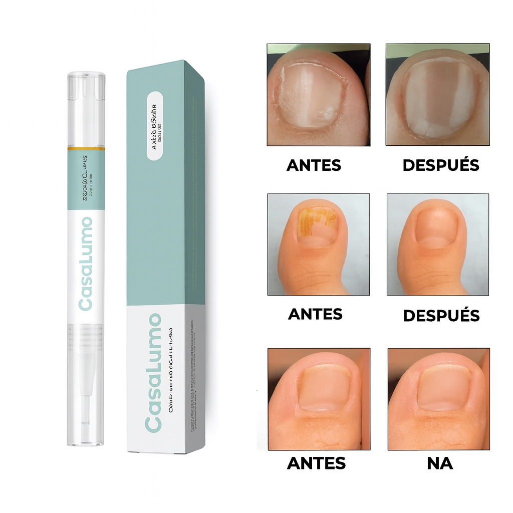 CASA LUMO | Pluma para Uñas con Hongos