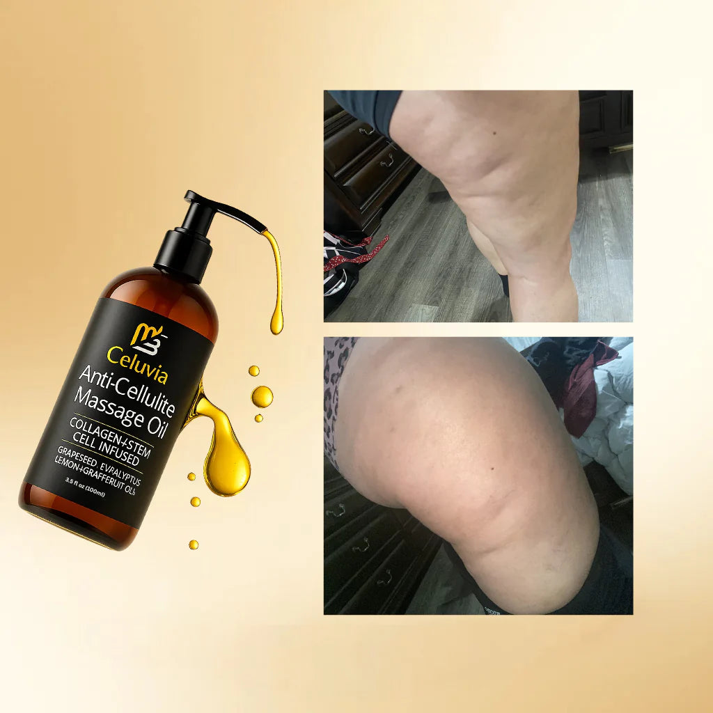 Aceite Anticelulitis Reafirmante Celuvia™