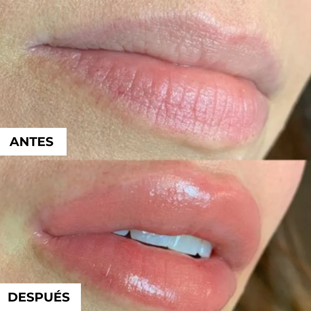 Voluminizador de Labios GLUMI