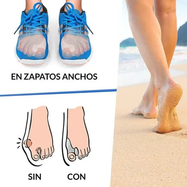 Corrector de Juanetes - Hallux-Valg™